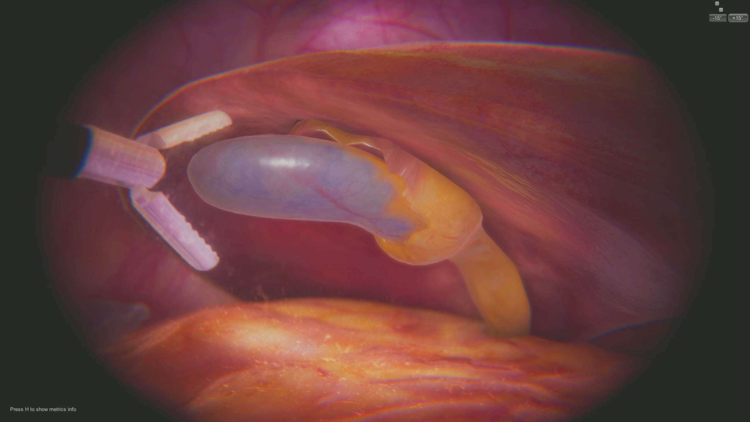 Oculus Quest 游戏《手术VR》SurgicaVR default-img.jpg